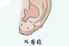 耳朵上的痣命相图解,耳朵有痣代表着什么