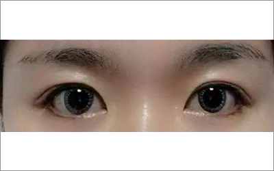 解析瑞凤眼和圆眼的眼型是什么意思？
