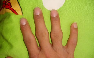 女人的手指关节大命怎么样？是什么意思？