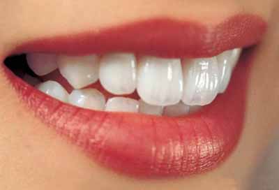 女人牙齿不齐的面相怎么样